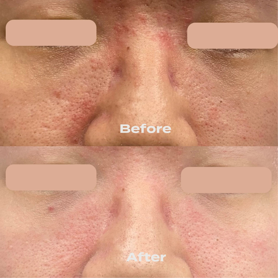 B-Restore Barrier Cream + Free 20g Travel Size