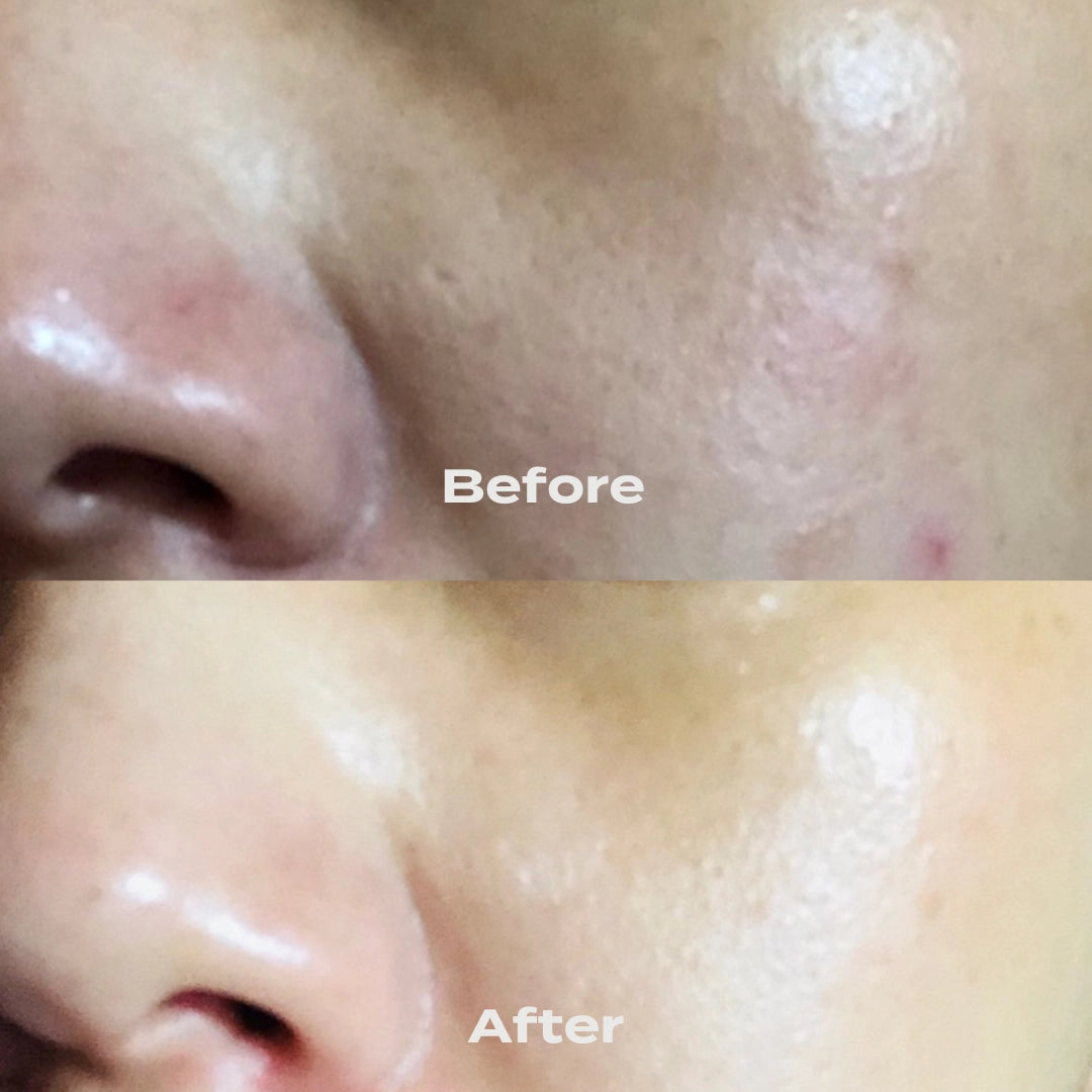 B-Restore Barrier Cream + Free 20g Travel Size